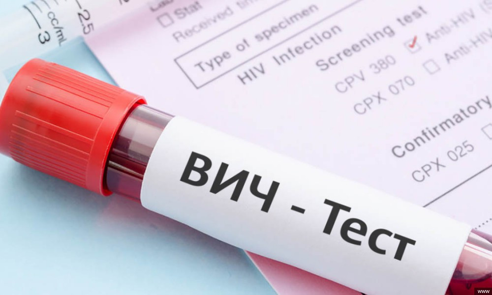 ВИЧ инфекциясына чалдыккандар көбөйүүдө